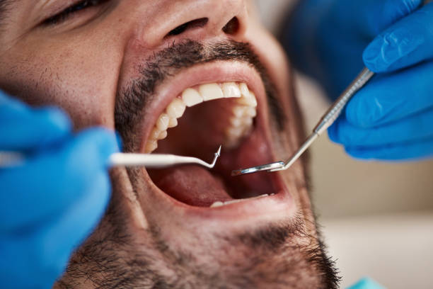 Best Dentist for Tooth Abscess  in Third Lake, IL
